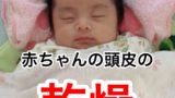 新生児 乳児や子供の顔にも大丈夫 ヒルドイドの使い方や効果 退職ヒーロー